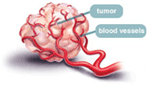A tumor and blood vessels
